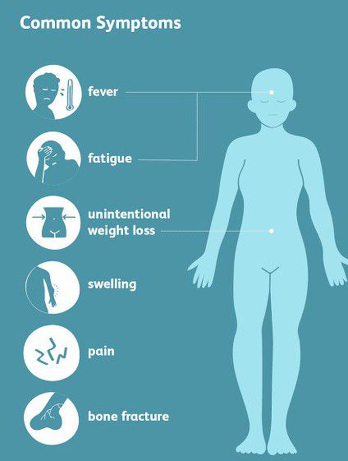 Chondrosarcoma symptoms