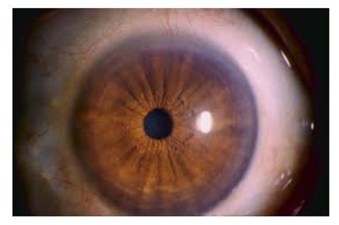 Ophtalmology