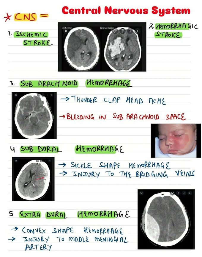 Radiology Review II