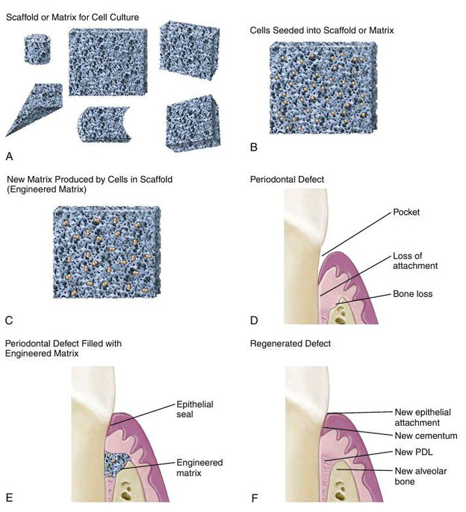 Periodontal ligament engineering