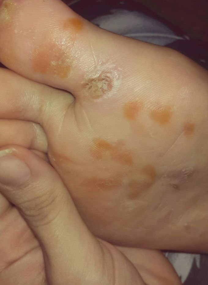 What is diagnosis?