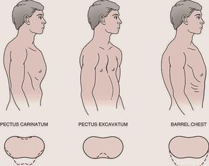 Barrel shaped chest