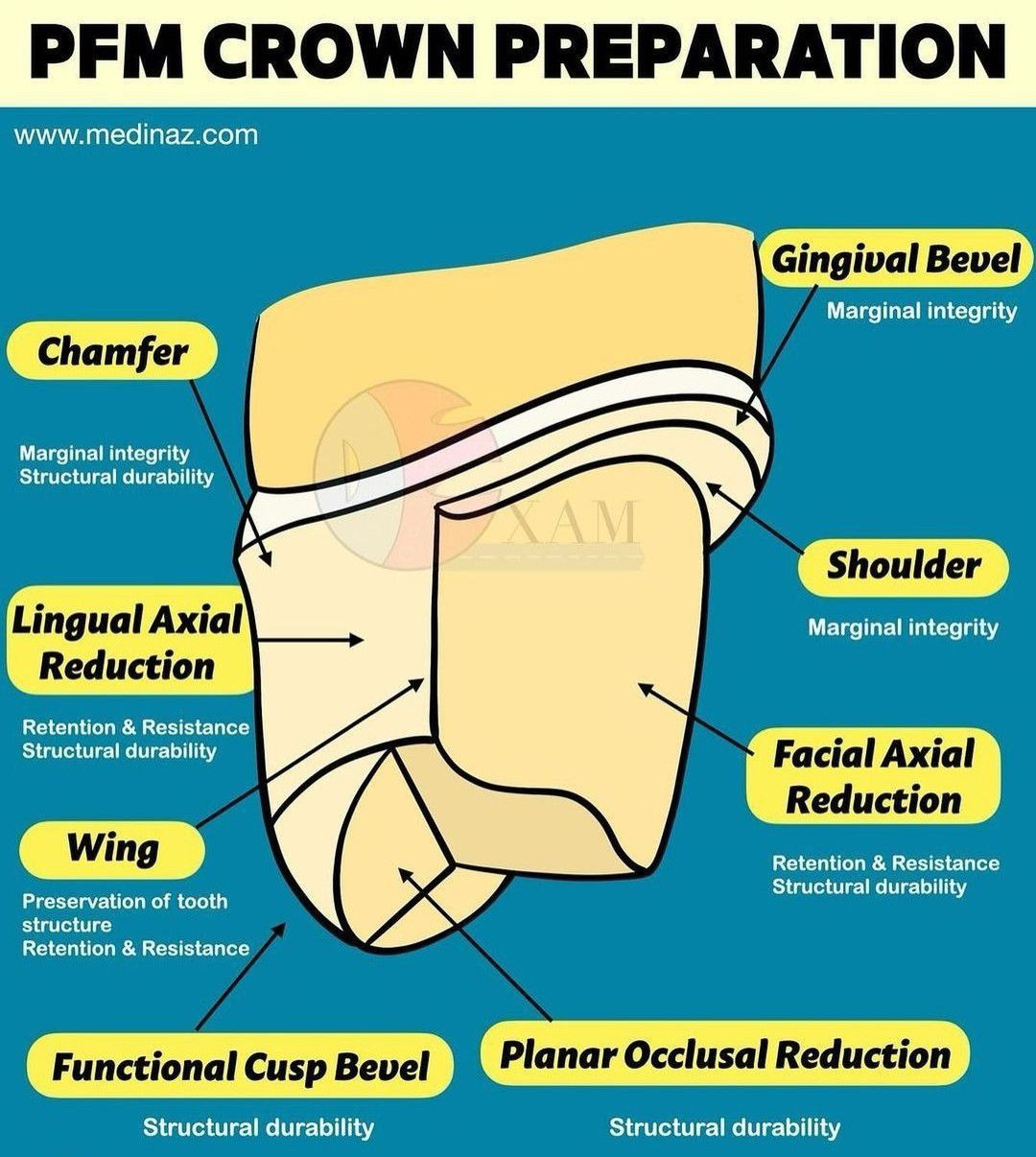 Pfm Crown Preparation PRINCIPLES OF TOOTH PREPARATION PART 7