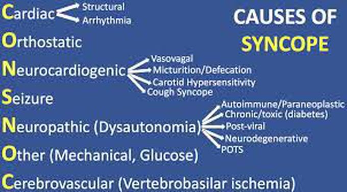 Causes of syncope