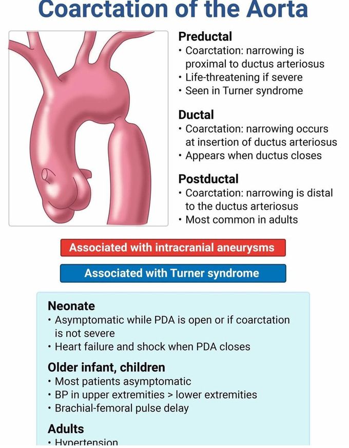 Coarctation of Aorta