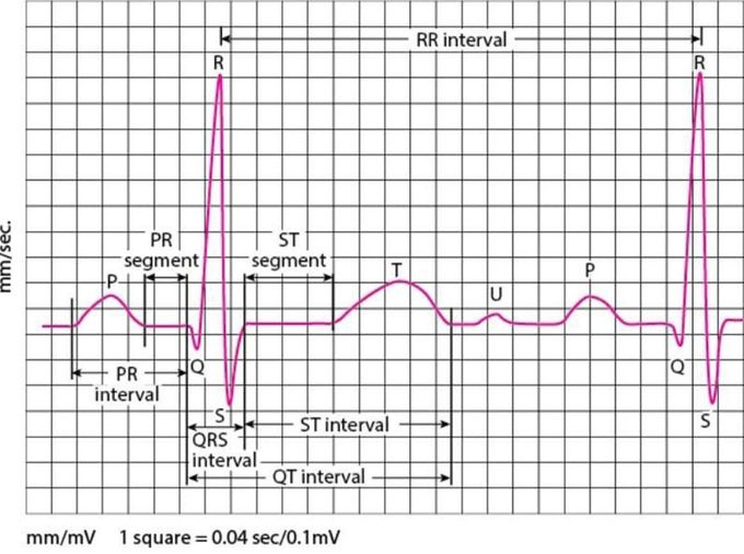 Normal ECG
