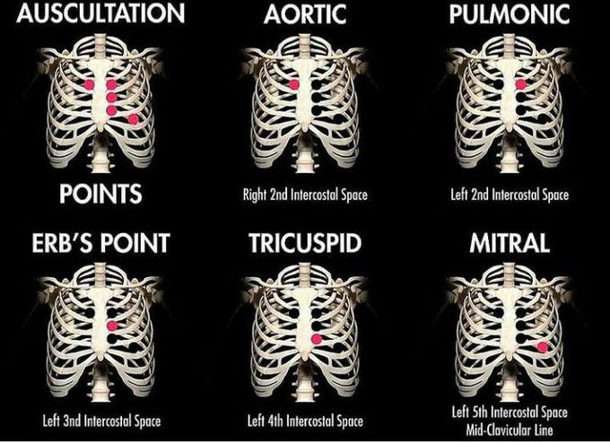 Points of Auscultation