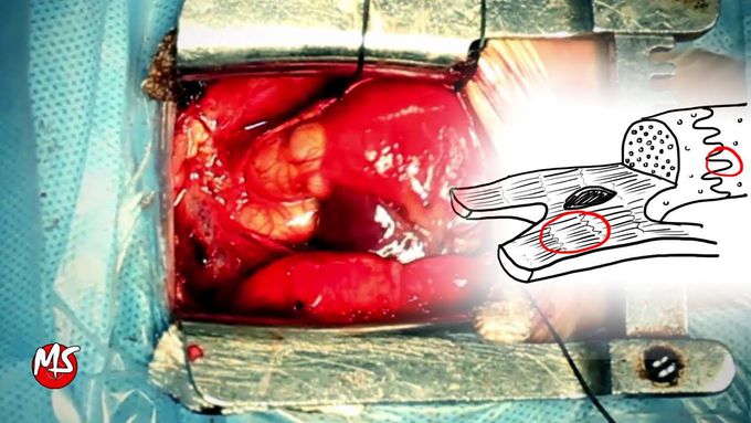 Cardiac Muscle Contraction | Structural organization