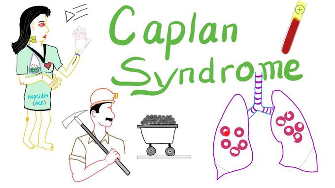 Caplan Syndrome