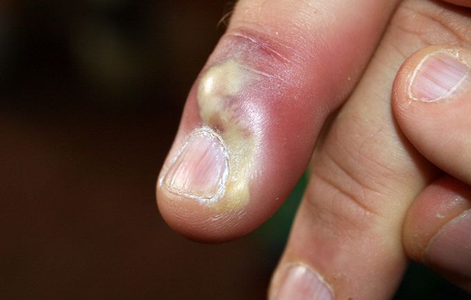 What's your diagnosis?