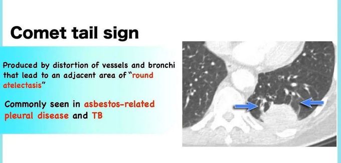 Comet Tail sign