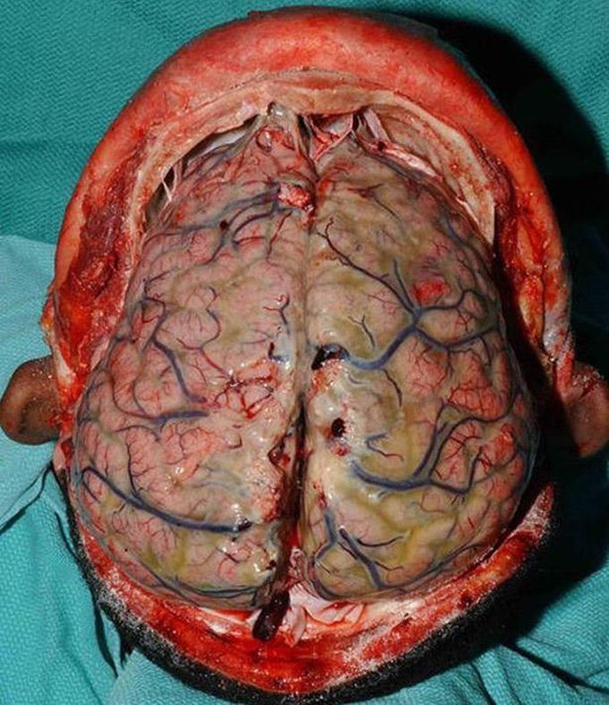 Diagnosis?