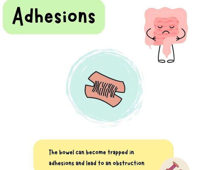 Adhesion