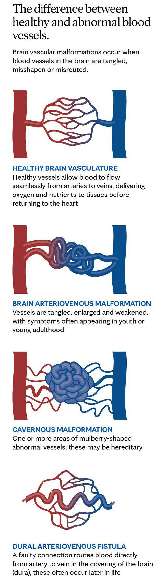 The differenec between healty and abnormal blood vessels..❤❤