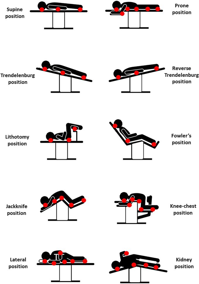 Positioning in Operating Room