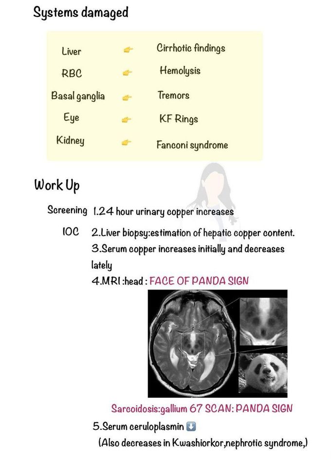 Wilson's Disease