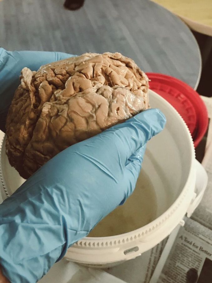 Human brain 🧠