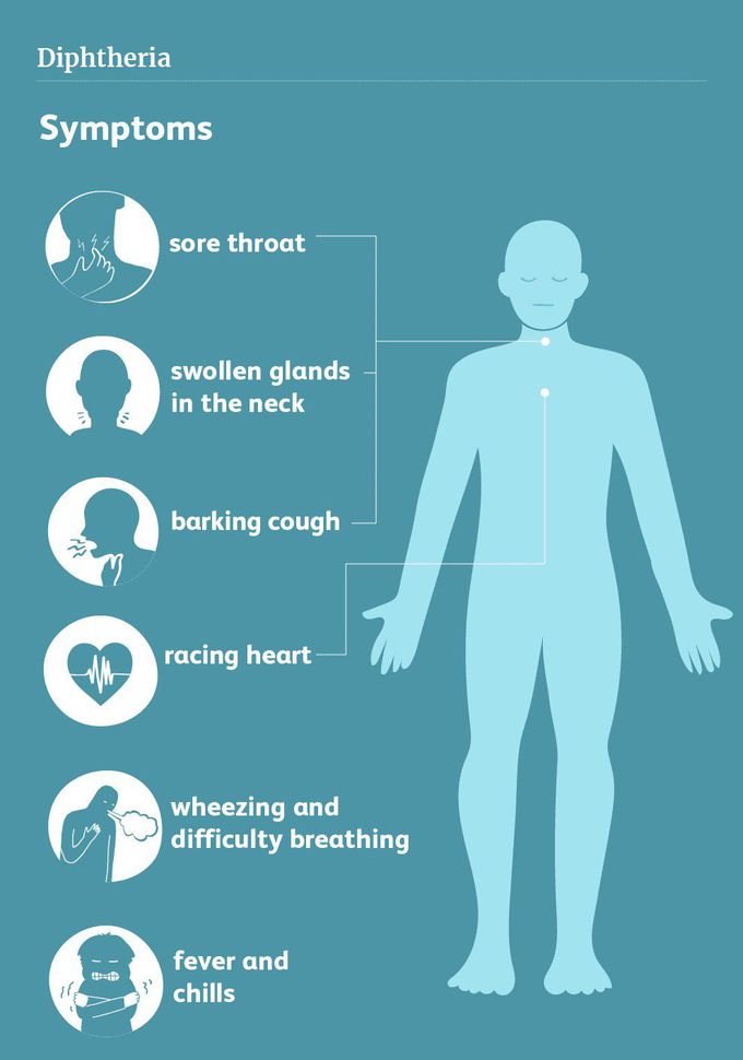 Symptoms of Diphtheria