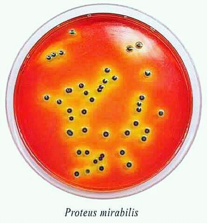 Proteus mirabilis Bacteria growth on plate of blood agar