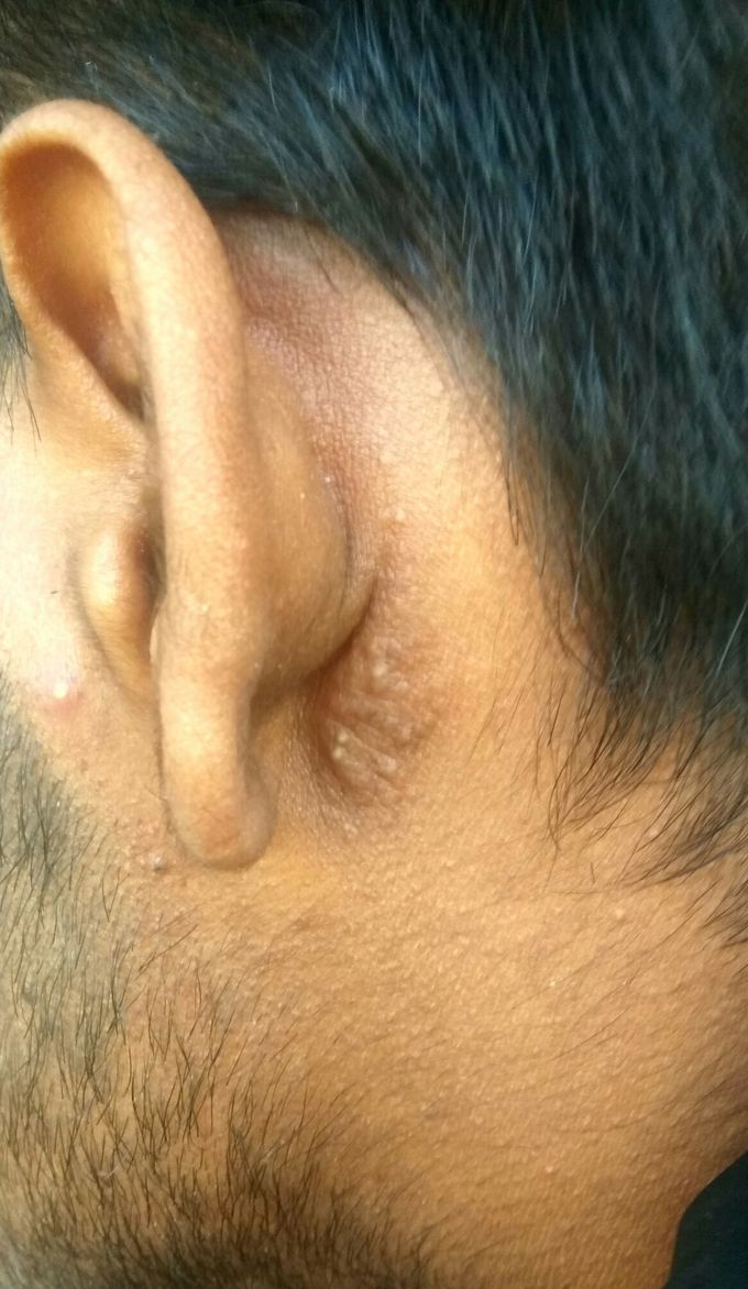 Diagnosis !?!?