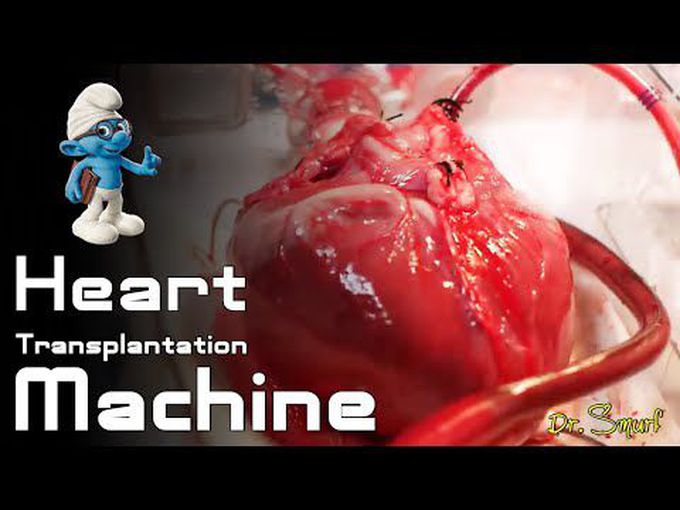 Heart Transplantation Machine