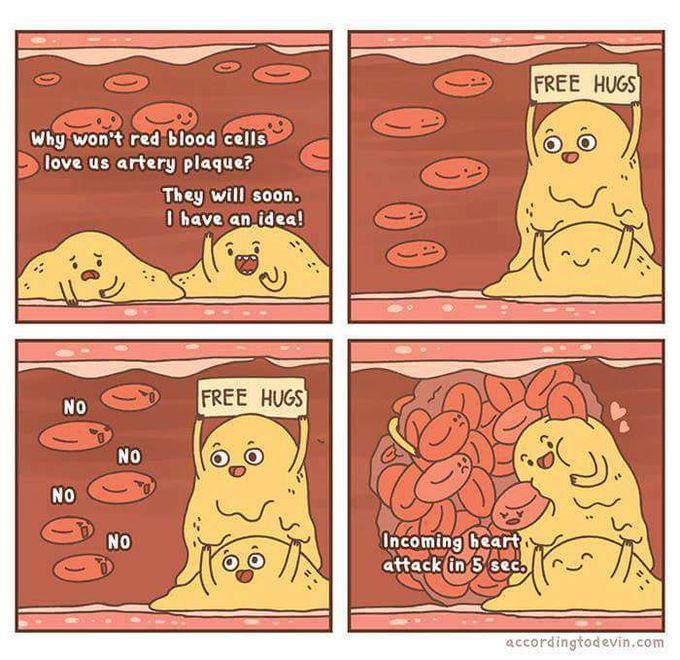 XD