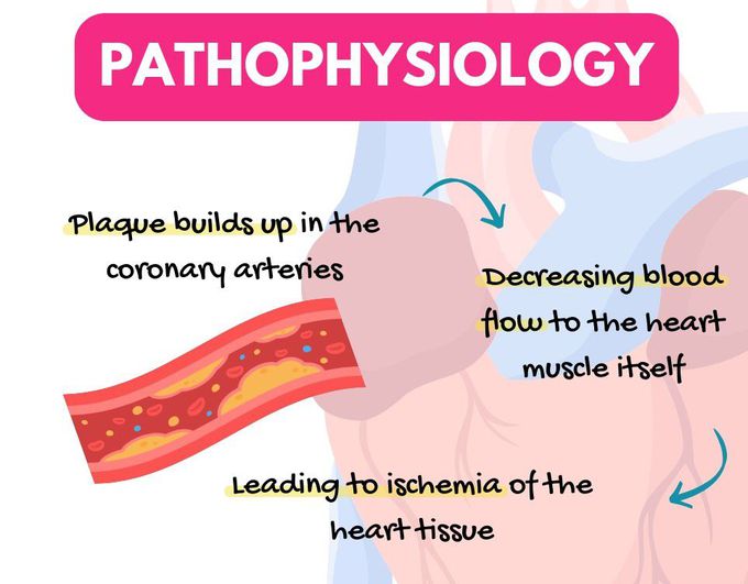 Coronary Artery Disease I