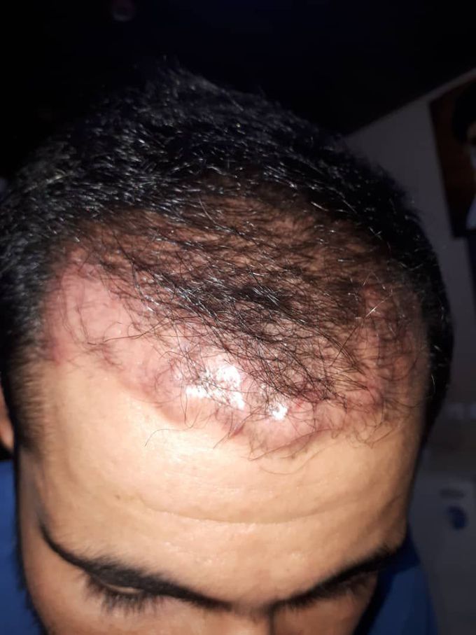 What is your diagnosis?