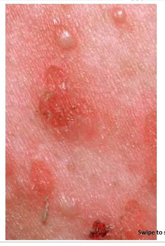 Skin problem