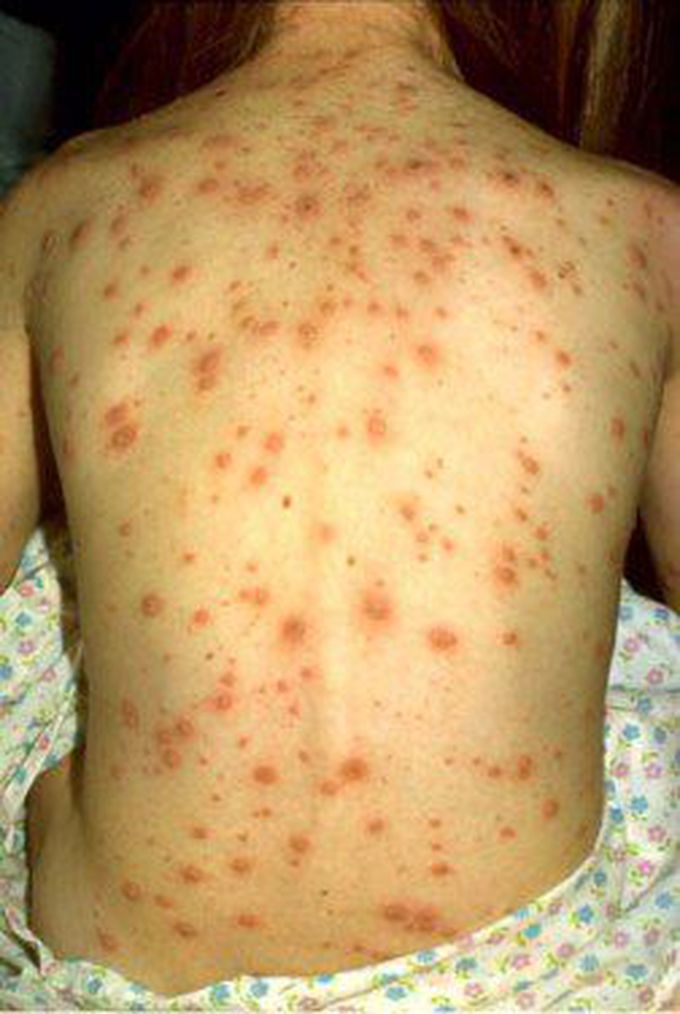 What's your diagnosis?