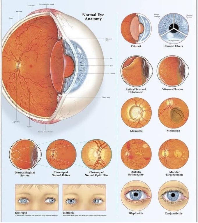 Disorders Of The Eye