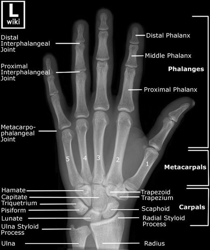 Adult Hand - PA/DP View
