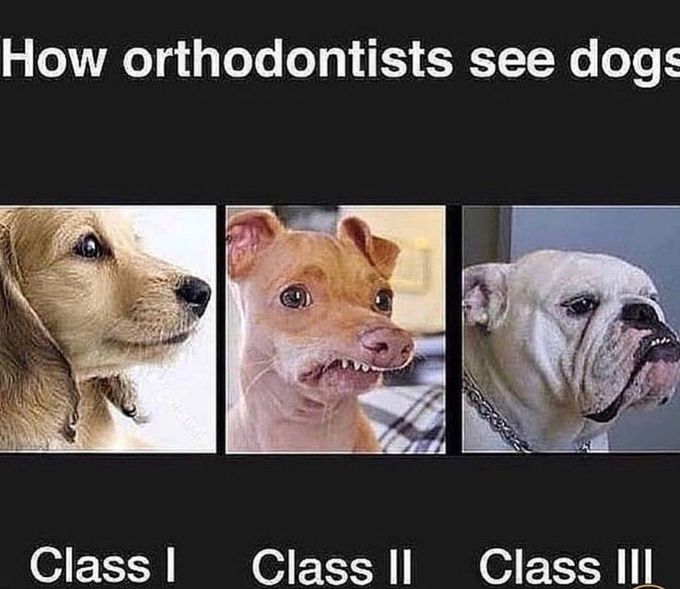 Angle's Classification of Malocclusion