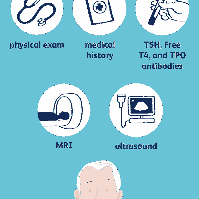 DIAGNOSIS OF HYPOTHYROIDISM