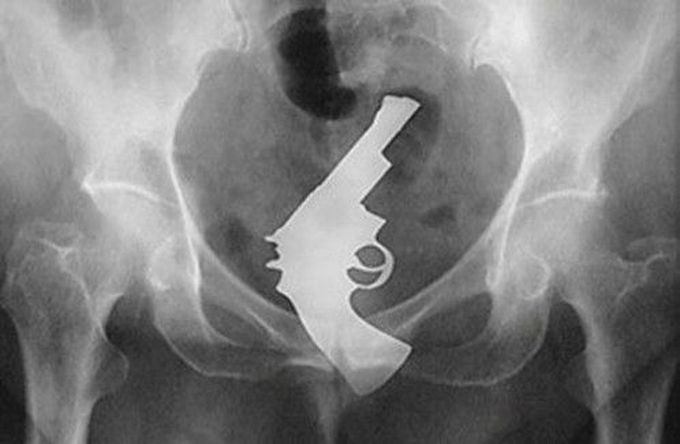 Radiographie insolite