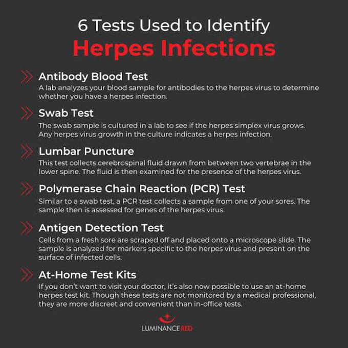 Test for Herpes Infection