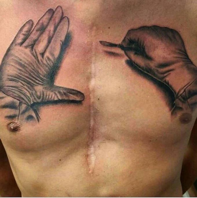 Interesting tattoo to cover up scar of surgery