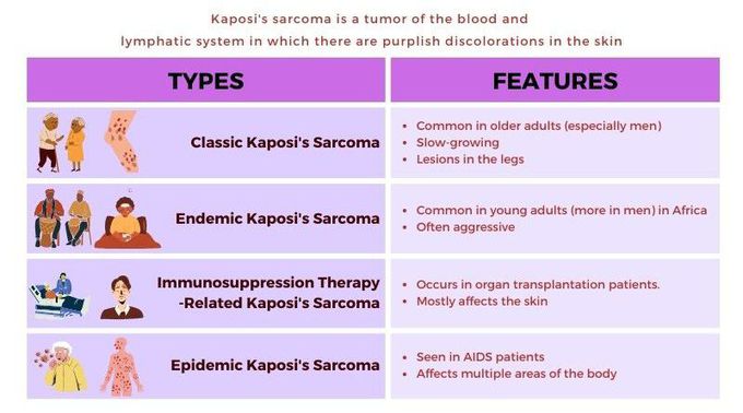 Types of Kaposi sarcoma