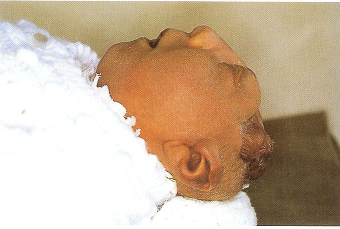 Whats your Diagnosis ??
