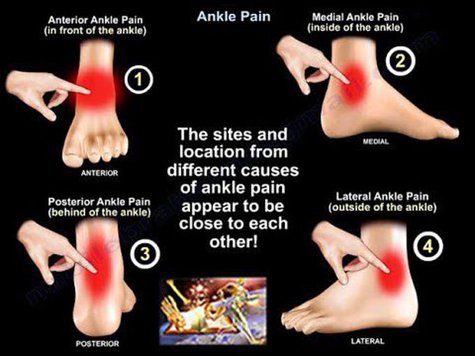 Ankle Pain - Everything You Need To Know - Dr. Nabil Ebraheim