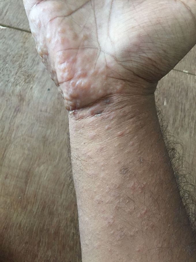 Anyone can diagnose it