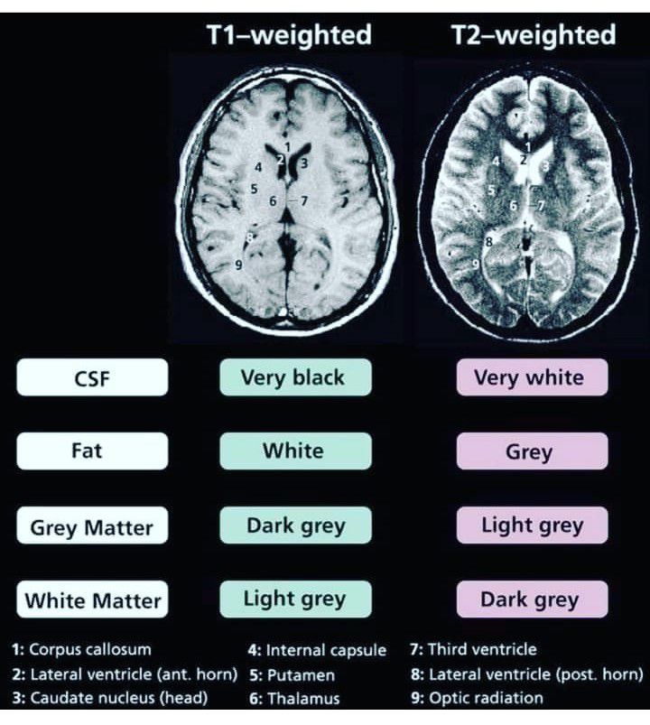 t1-weighted-vs-t2-weighted-medizzy