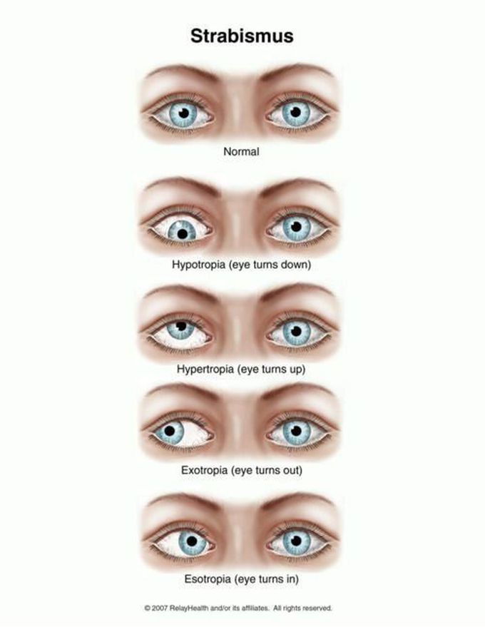 OPTHALMOLOGY