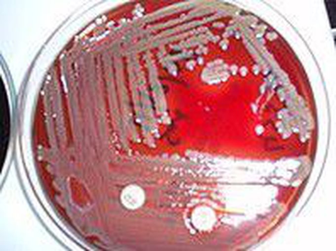 Blood hemolysis