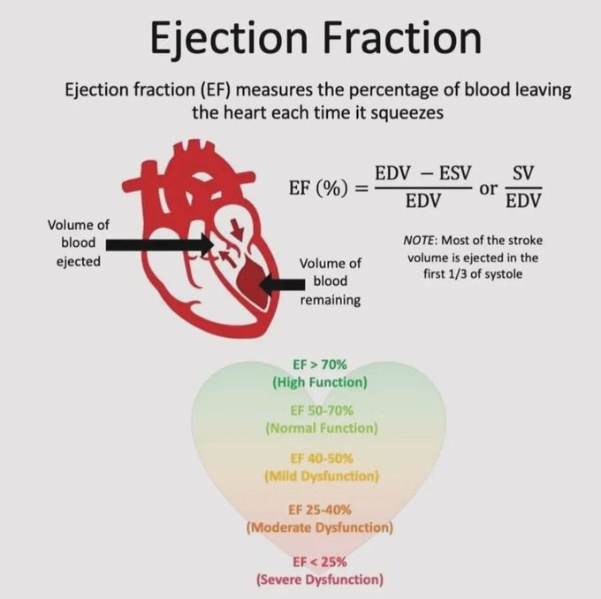 Ejection Fraction