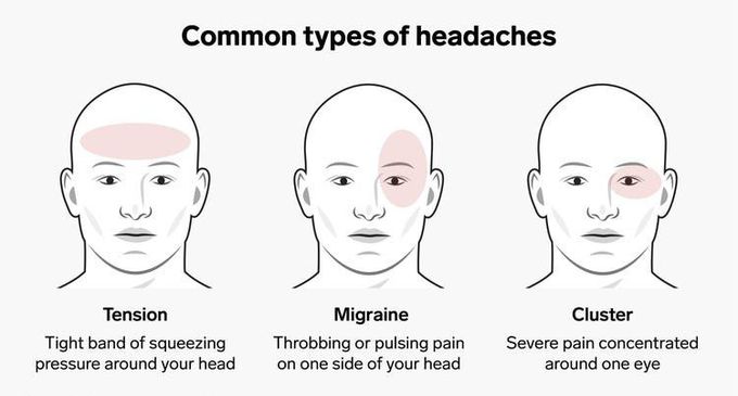 Types of Headache
