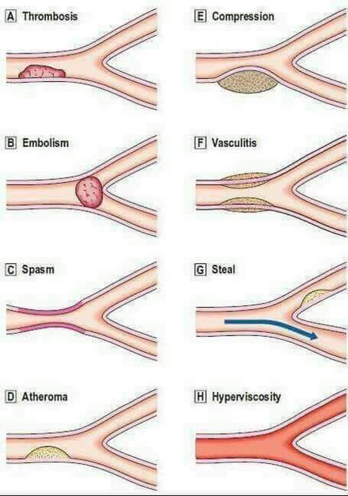 Pathologies of the vascular system
