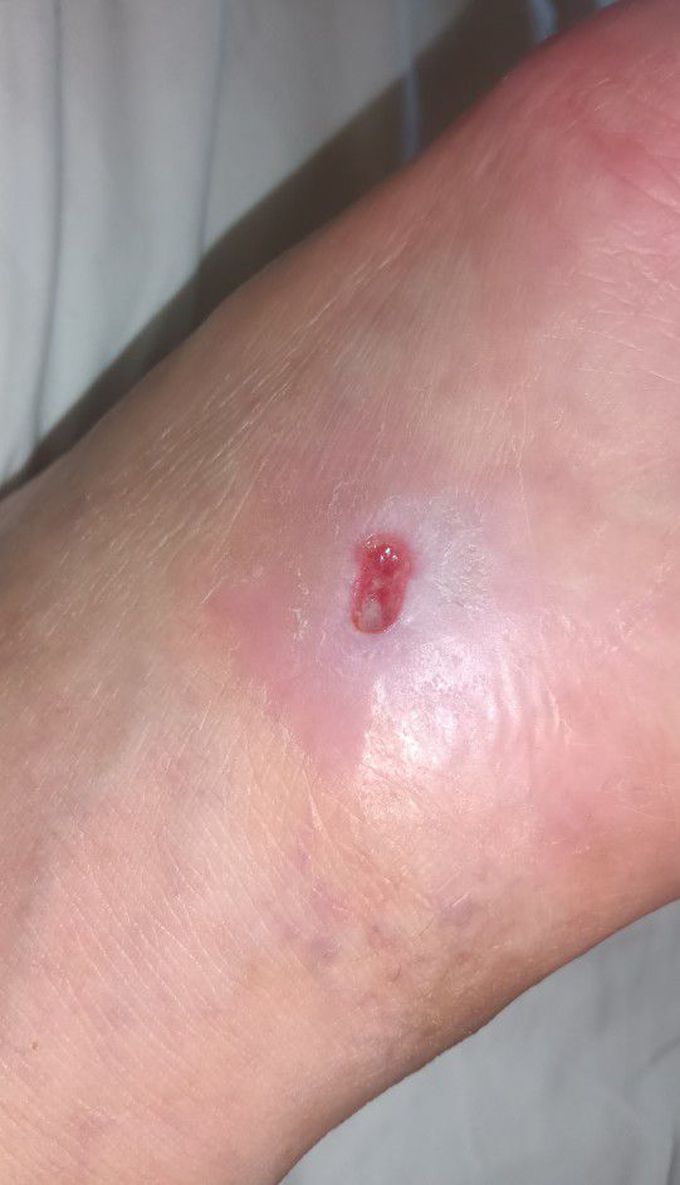 My foot