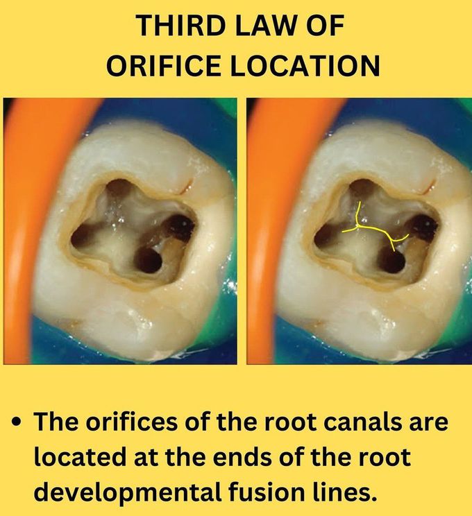 Third Law of Orifice Location