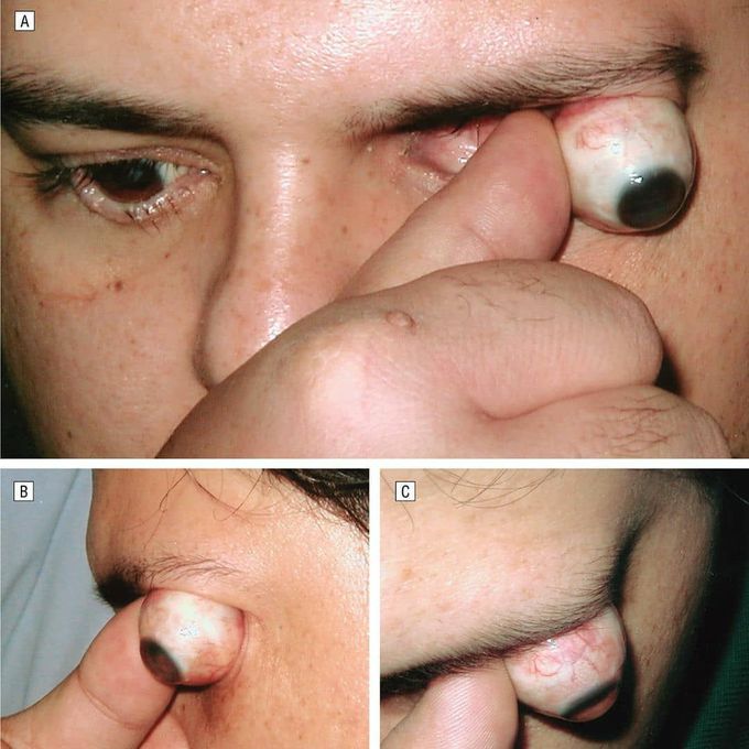 Ophthalmology